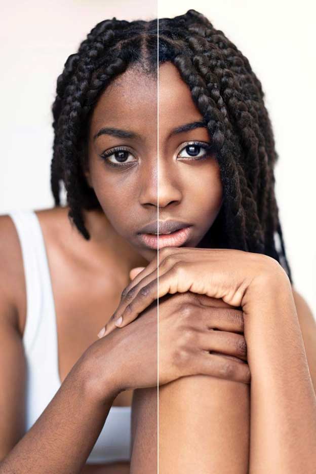 Skin rejuvenation before and after results