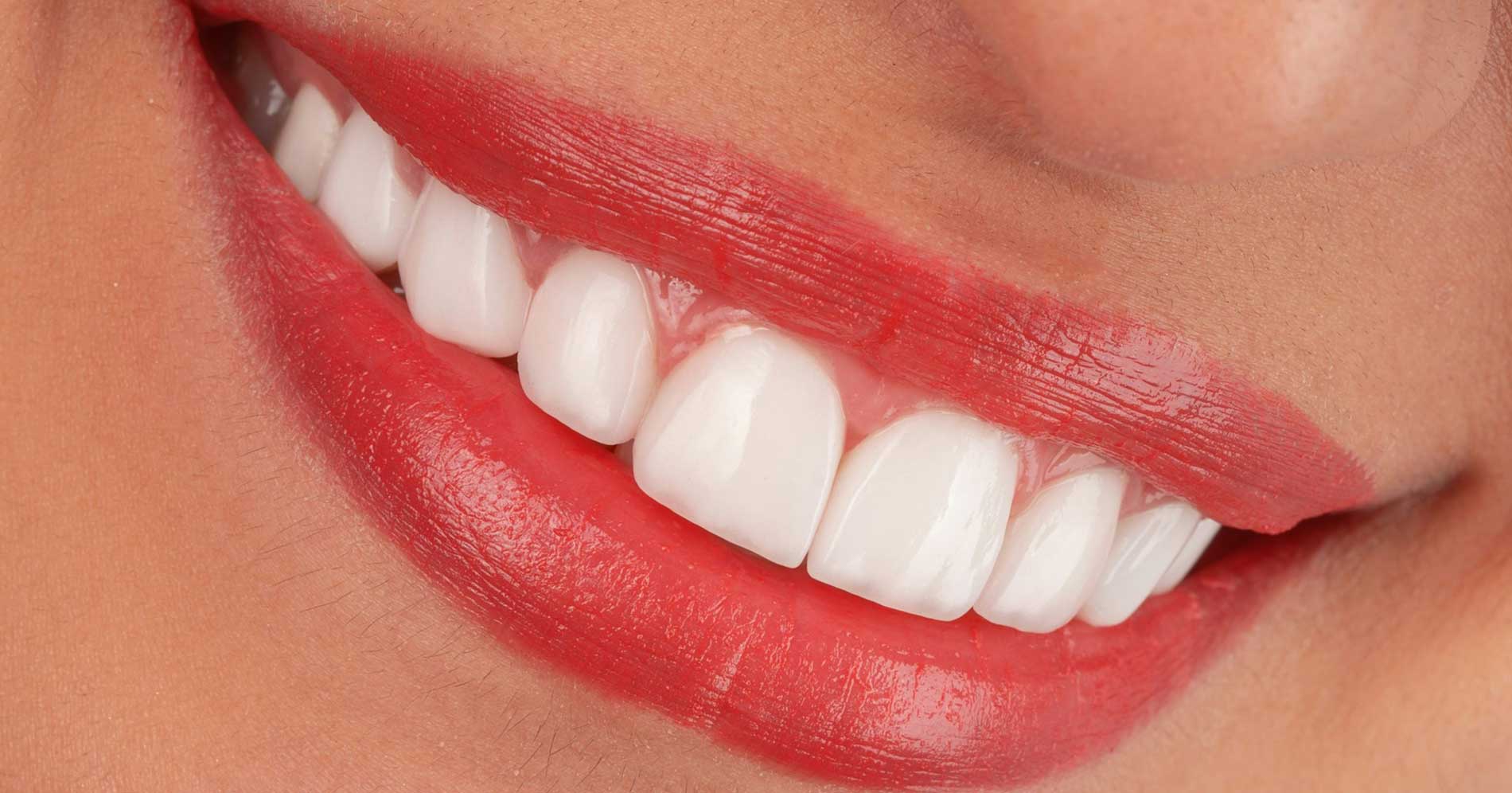 Natural-looking denture smile